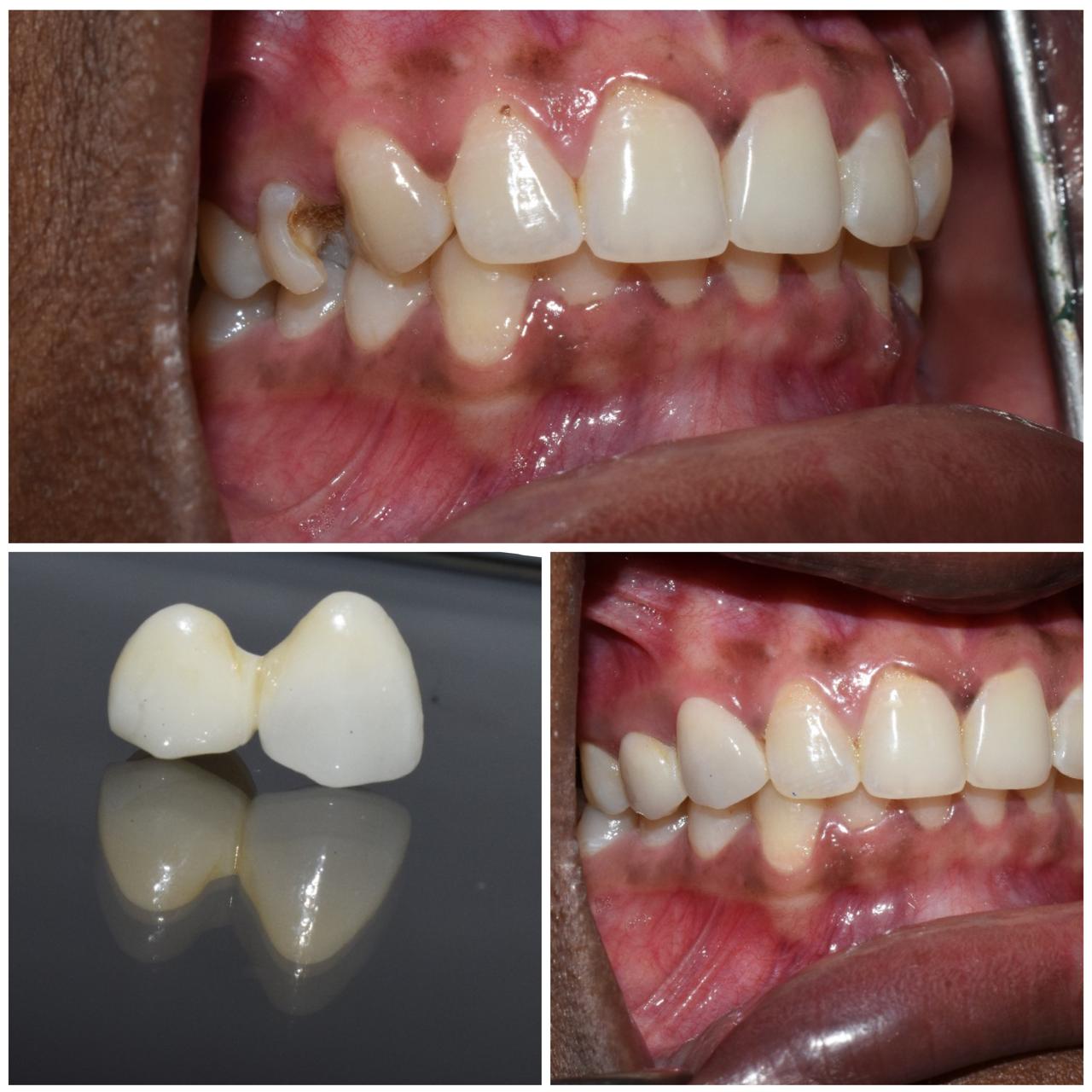 Dental